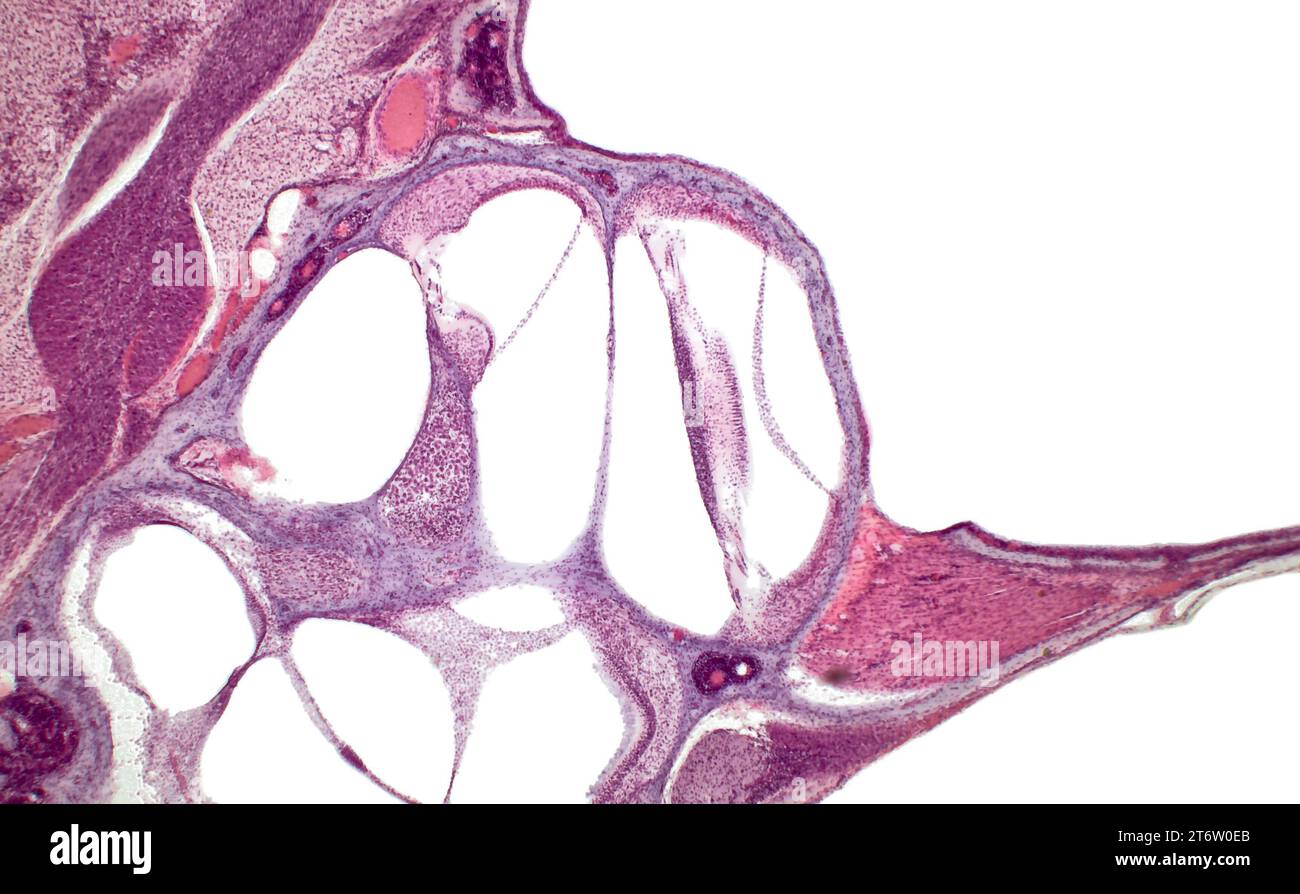 Orgue de Corti (orgue spiralé). Histologie de la cochlée de l'oreille interne. Coloration à l'hématoxyline et à l'éosine. Banque D'Images