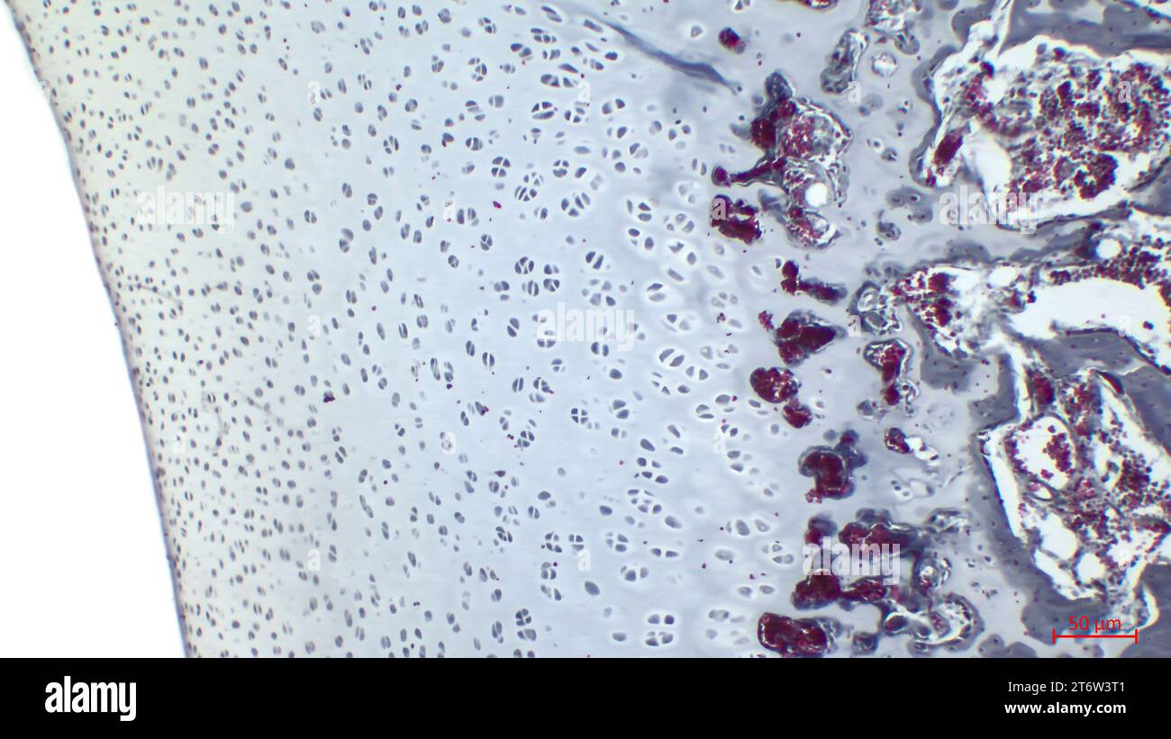 Coupe histologique du cartilage hyalin montrant des chondrocytes dans les lacunes et la matrice extracellulaire. Banque D'Images