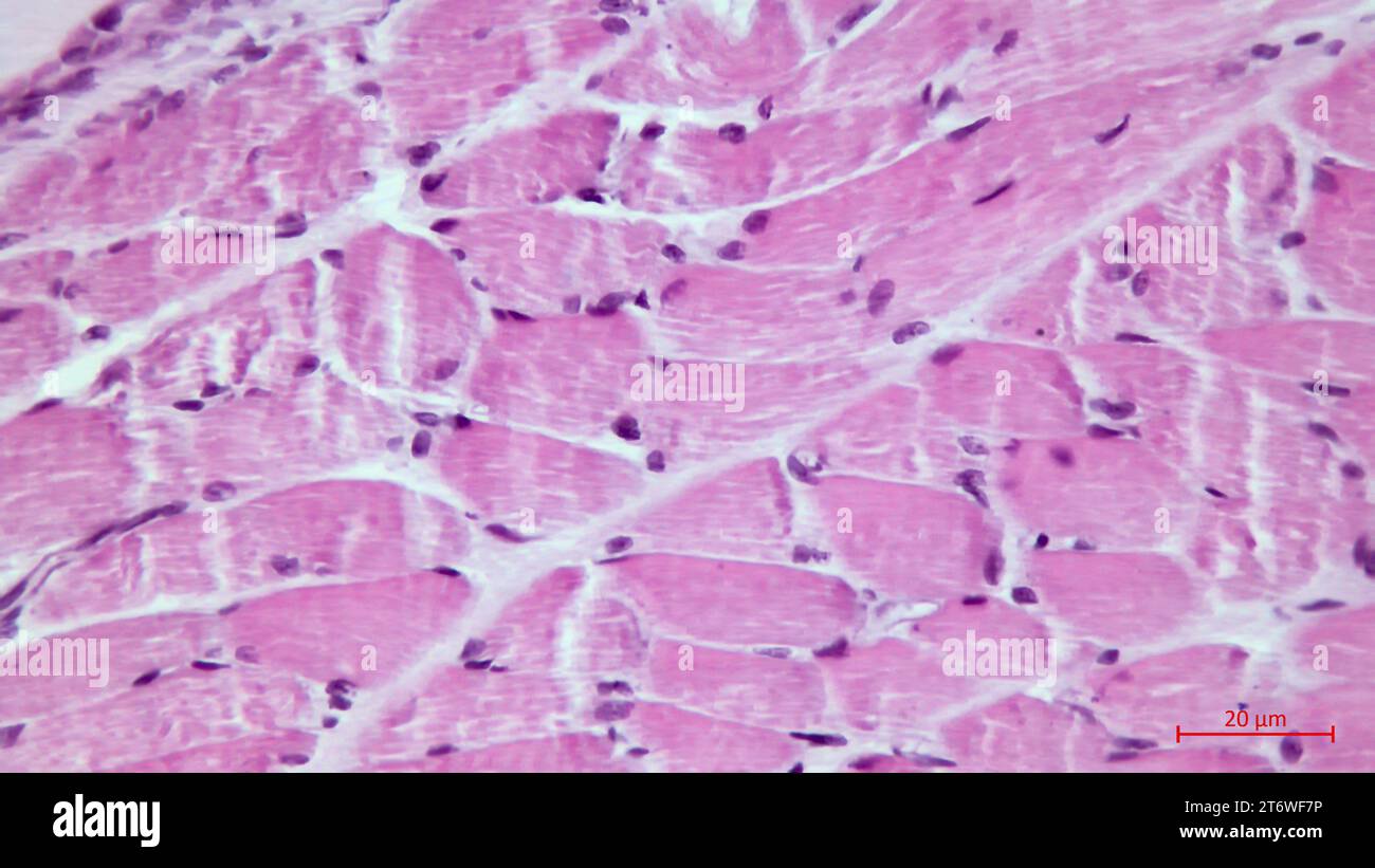 Micrographie légère d'une coupe de muscle squelettique. Fascicules de fibres musculaires. Coloration de l'éosine terminale à l'hématoxyline. Grossissement : x200 Banque D'Images