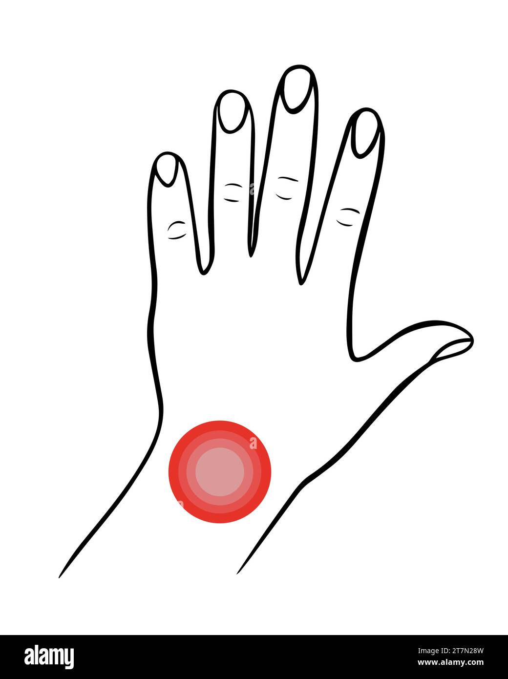Illustration isolée vectorielle de douleurs au poignet. Main avec localisation de douleur au poignet. Illustration de Vecteur Illustration isolée vectorielle de douleurs au poignet. Main avec localisation de douleur au poignet. Illustration de Vecteur