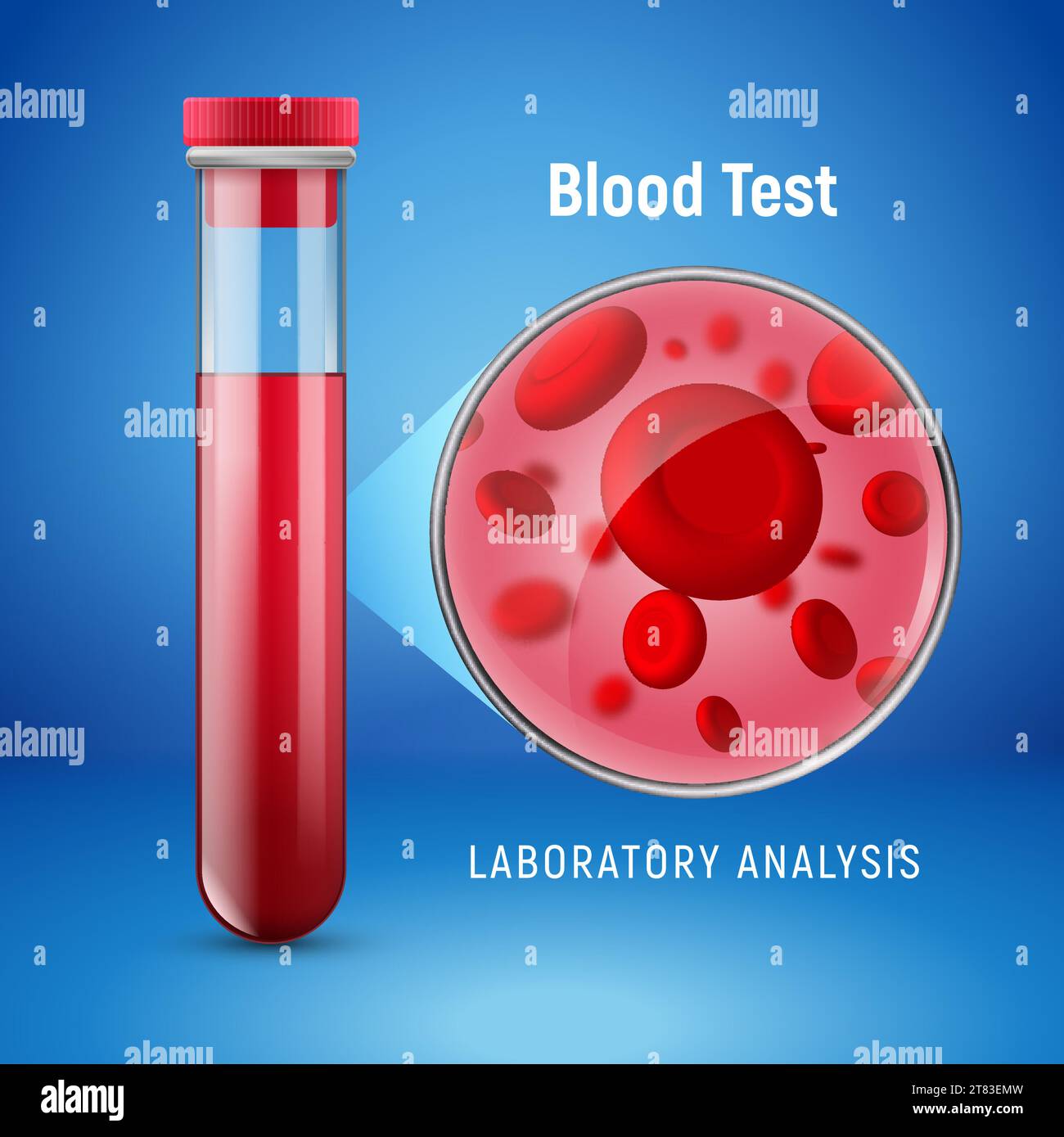 Concept d'hématologie avec tube de globules rouges analyse de laboratoire plat examiner. Hématologie liquide de globules rouges de sang. Illustration de Vecteur