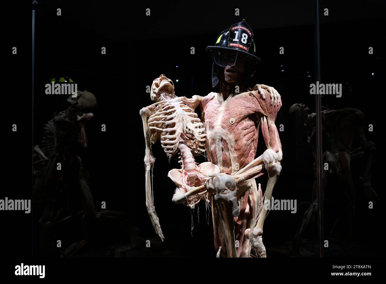 Zagreb, Croatie. 21 novembre 2023. Un plastiné est sur un mécontentement lors de l'exposition Body Worlds Vital de l'anatomiste allemand Gunther von Hagens au Family Mall le 21 novembre 2023 à Zagreb, Croatie. L'exposition présente des corps humains et des organes préservés par le processus de plastination permettant aux corps de s'installer dans n'importe quelle position. L’exposition anatomique body Worlds Vital aura lieu du 21 novembre 2023 au 17 février 2024. Photo Davor Puklavec/PIXSELL crédit : Pixsell/Alamy Live News Banque D'Images