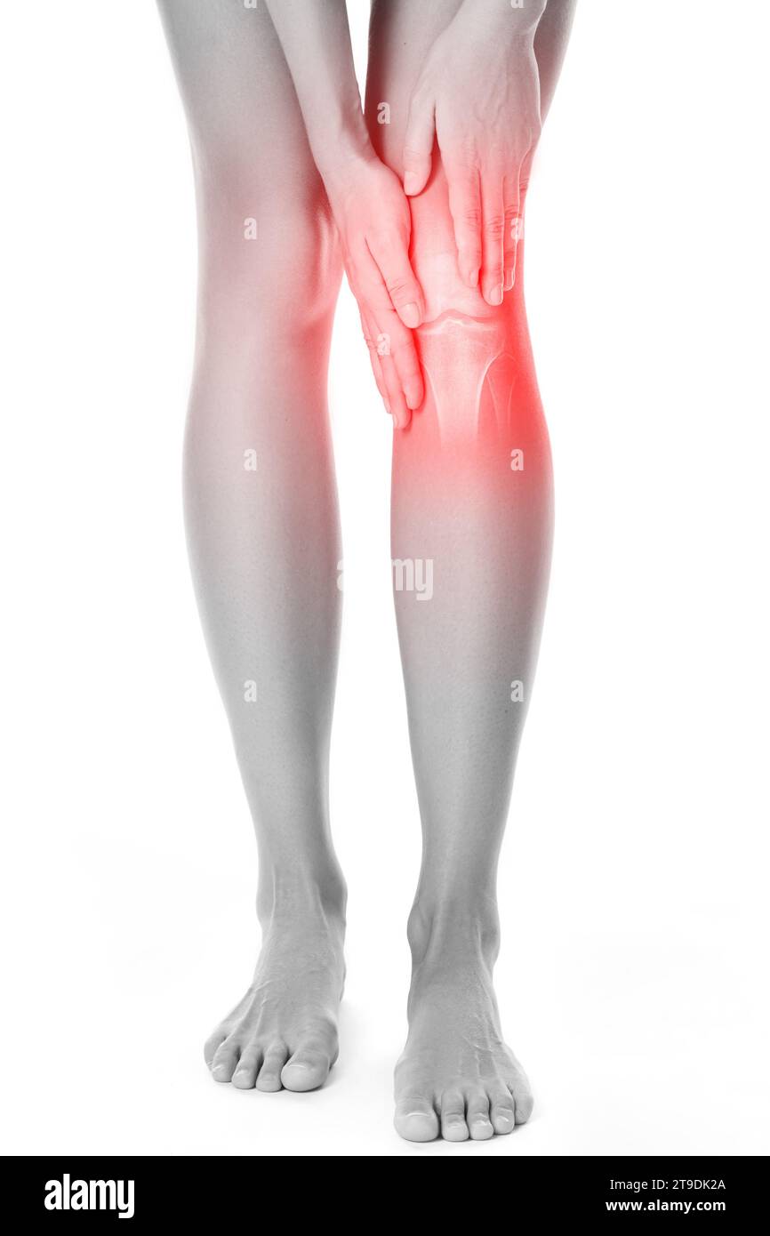 Genou féminin et effet radiographique avec articulation blessée Banque D'Images