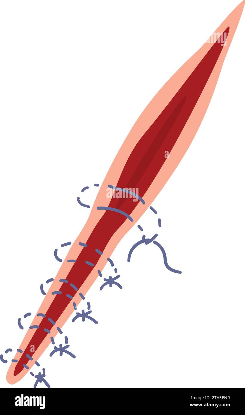 Vecteur de dessin animé d'icône de travail d'aiguille de suture. Lésion cutanée Illustration de Vecteur