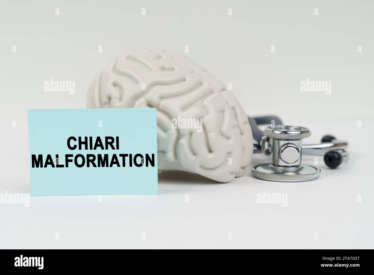 Concept médical. Sur une surface blanche à côté du cerveau, il y a un stéthoscope et des autocollants avec l'inscription - Chiari malformation Banque D'Images