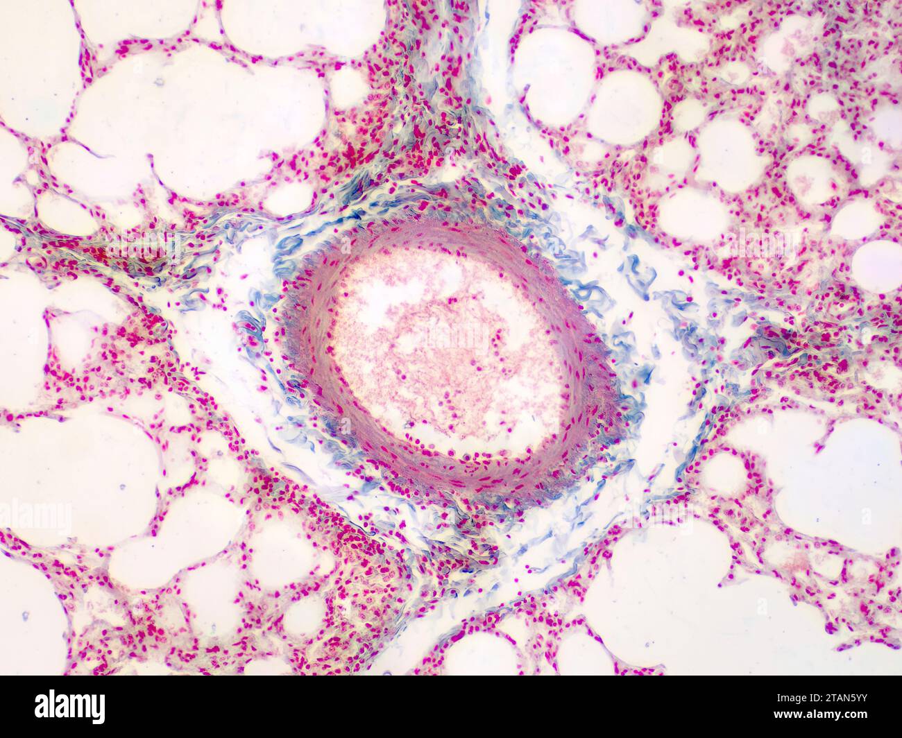 Tissu pulmonaire humain, micrographe léger Banque D'Images