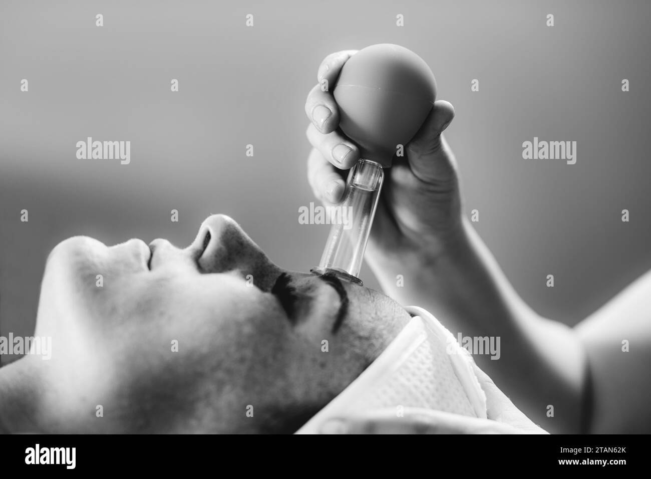 Cure de ventouses faciales Banque D'Images