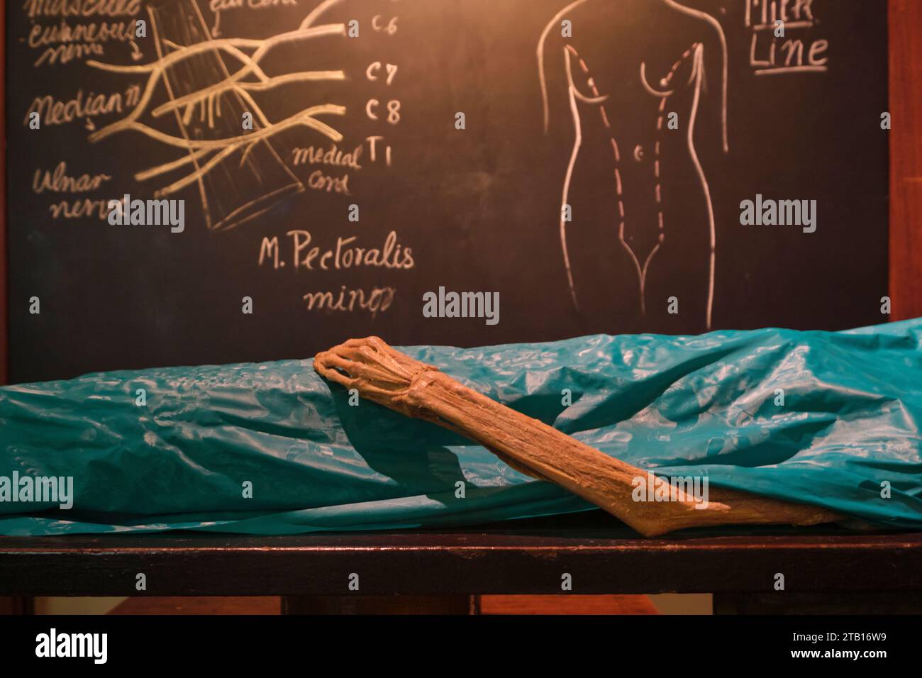 Détail dans une recréation d'un cours d'anatomie, avec corps mort pour dissection. Fait partie de l'exposition de l'hôpital Siriraj Piyamaharajkarun au Sirir Banque D'Images
