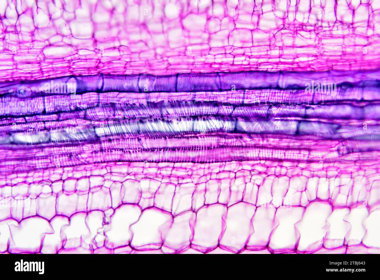 Xylème (Bryonia sp.). Microscope optique X100. Banque D'Images