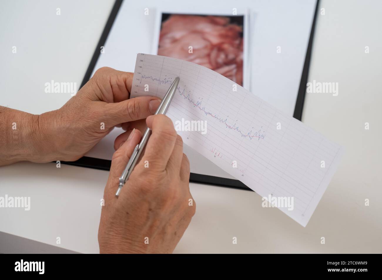 Le médecin examine la cardiotocographie fœtale. Banque D'Images