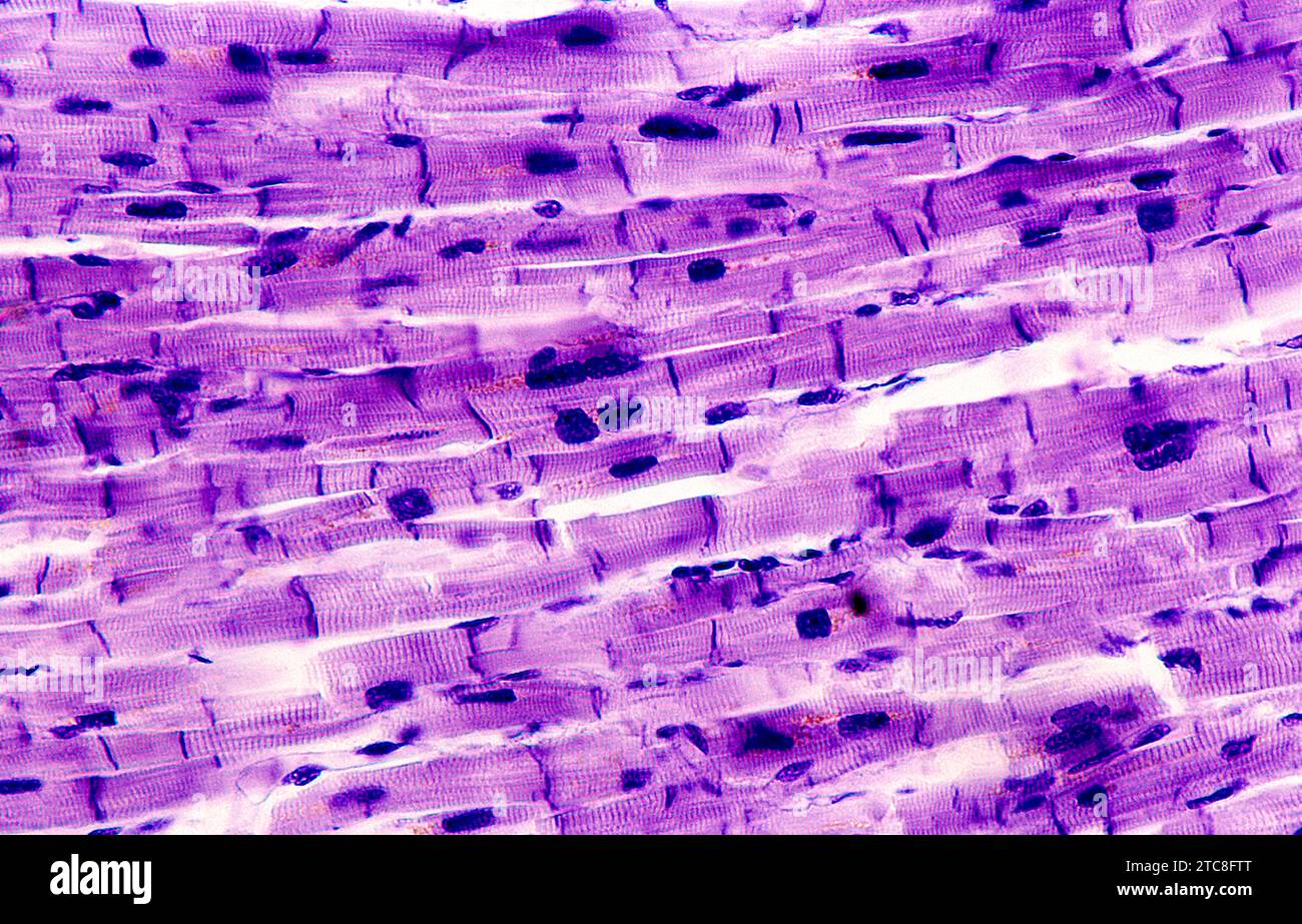 Le muscle cardiaque ou le muscle cardiaque est un muscle strié involontaire présent dans le coeur. Microscope optique, grossissement X200. Banque D'Images