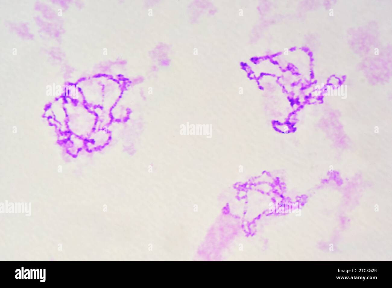 Chromosomes géants ou polytènes des glandes salivaires de Chironomus. Microscope optique X400. Banque D'Images