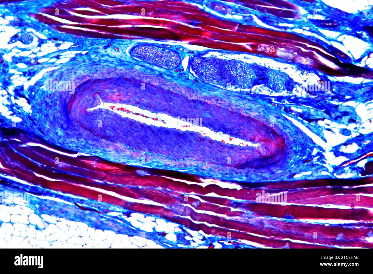 Artère (vaisseau sanguin). Microscope optique X150 à 10 cm de large. Banque D'Images