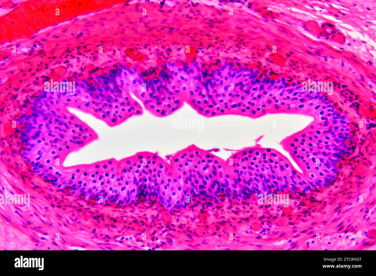 Artère (vaisseau sanguin) montrant une tunica adventice, un média et une intima. Microscope optique X300 à 10 cm de large. Banque D'Images
