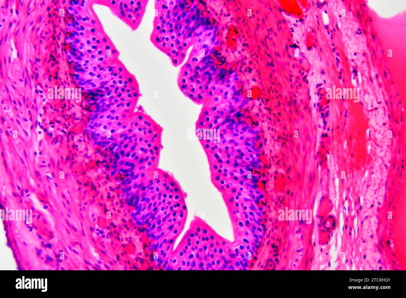 Artère (vaisseau sanguin) montrant une tunica adventice, un média et une intima. Microscope optique X300 à 10 cm de large. Banque D'Images
