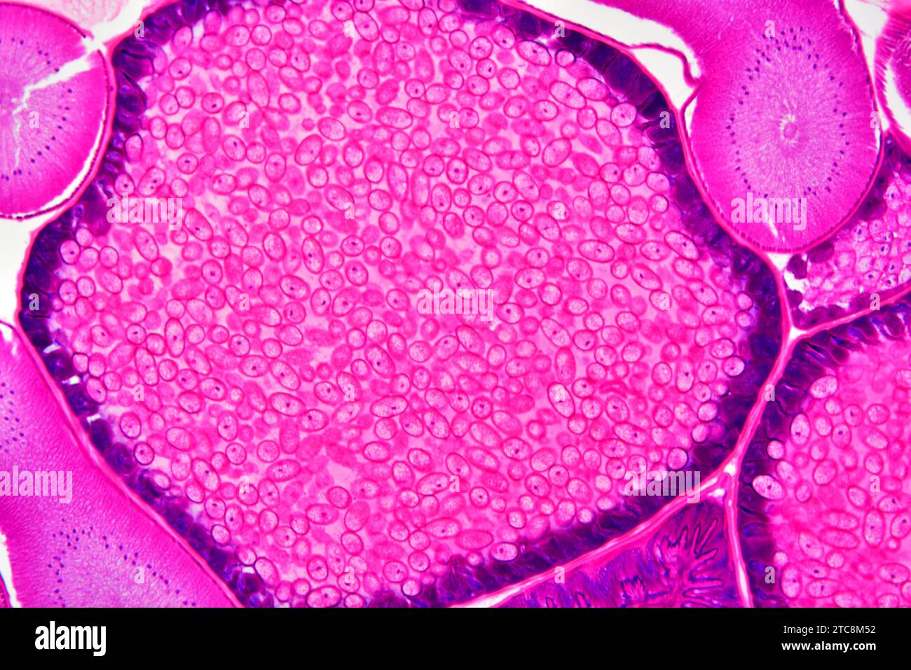 Ascaris lumbricoides femelle montrant les ovaires et l'utérus avec des oeufs. Microscope optique X150 à 10 cm de large. Banque D'Images