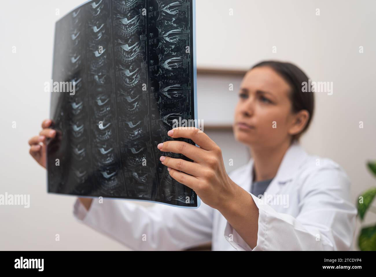 Gros plan médecin orthopédique évalue les films radiographiques des patients et les examens IRM semblent inquiets. Banque D'Images