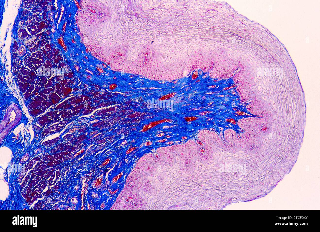 Œsophage humain ou œsophage présentant de l'épithélium squameux, du tissu conjonctif et des fibres musculaires lisses. Photomicrographe X50 à 36 mm de largeur. Banque D'Images