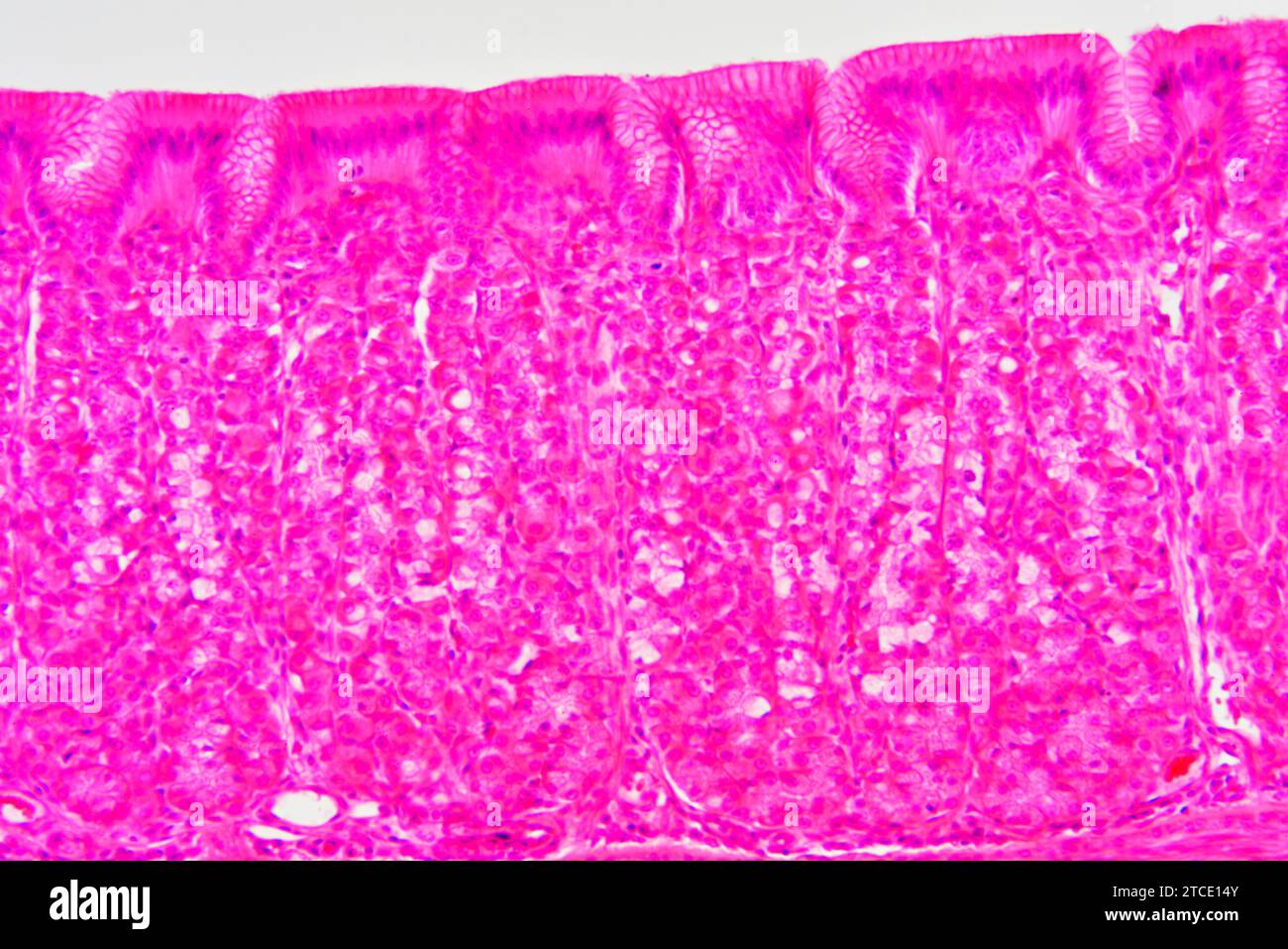 Section transversale de l'estomac montrant la muqueuse, la sous-muqueuse et les glandes gastriques. Microscope optique X200. Banque D'Images