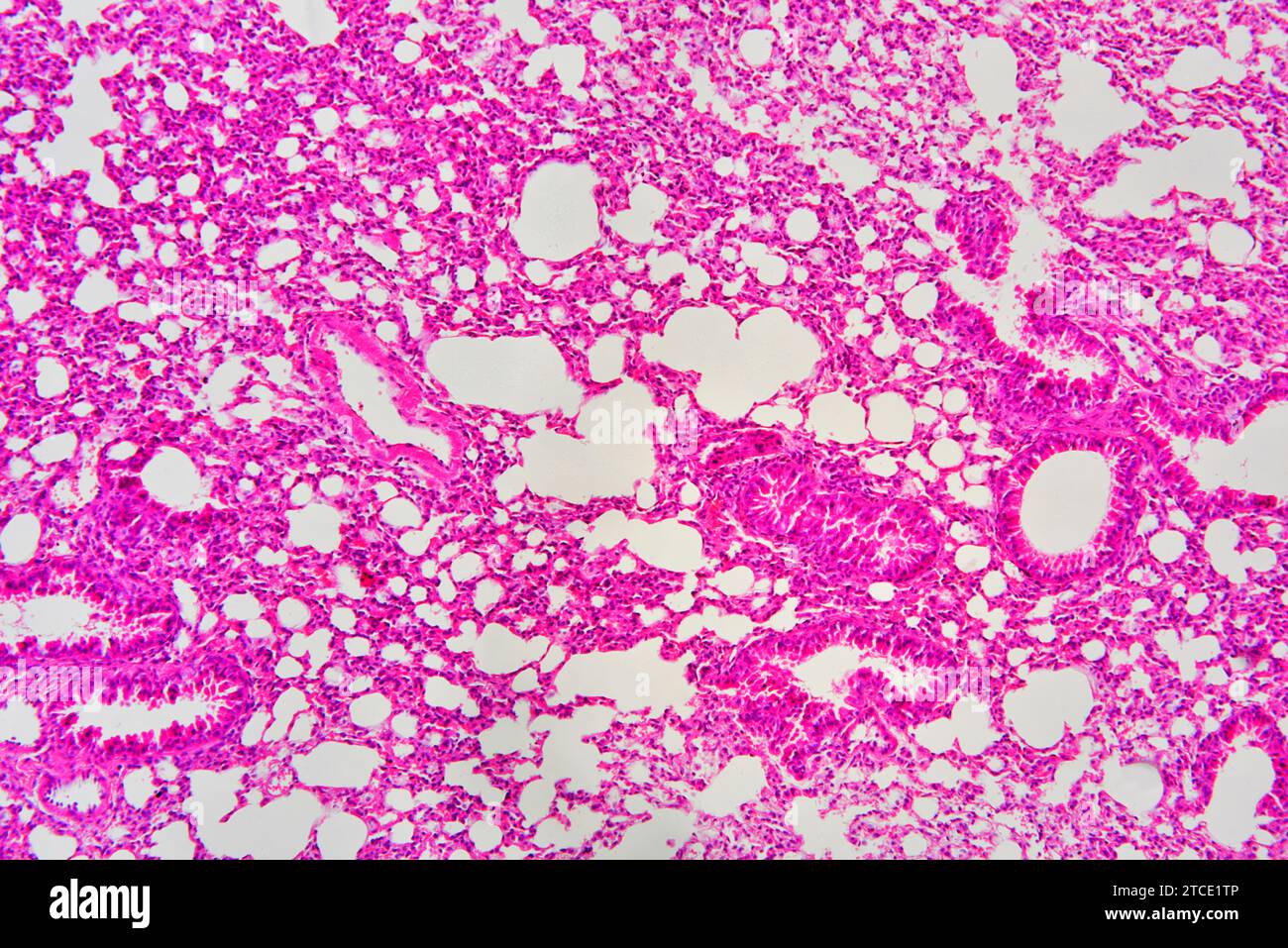Section pulmonaire humaine montrant l'alvéole, le bronchiole et le vaisseau sanguin. Microscope optique X100. Banque D'Images