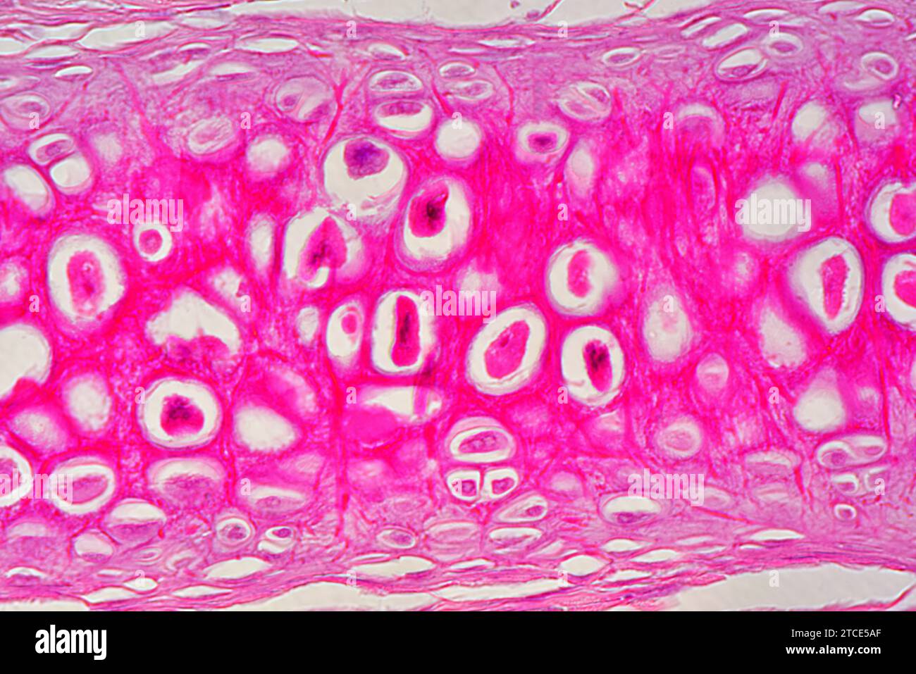 Tissu cartilagineux élastique de l'oreille montrant les chondrocytes, les fibres d'élastine et la matrice. Microscope optique X400. Banque D'Images