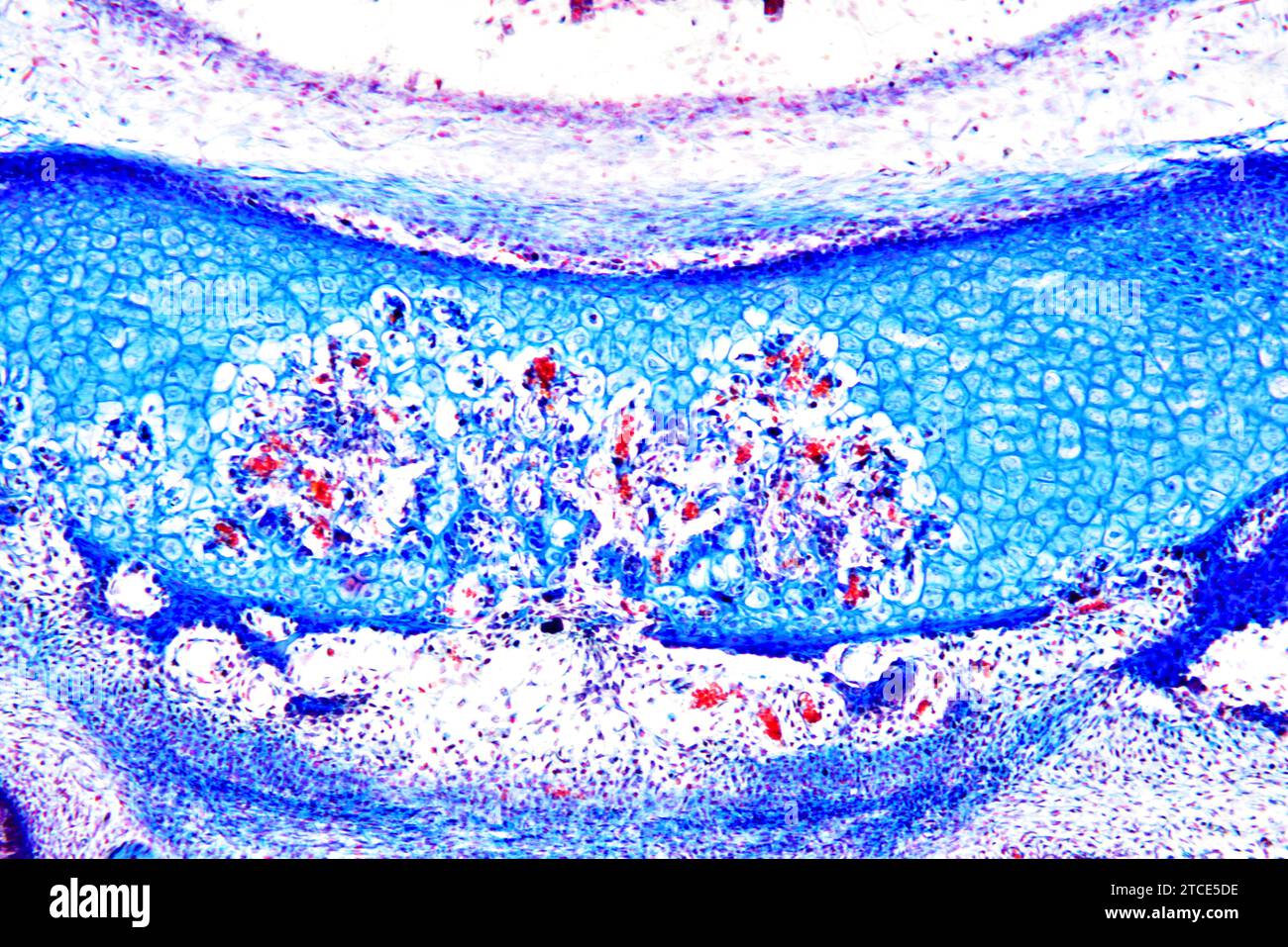 Tissu cartilagineux élastique de l'oreille montrant les chondrocytes, les fibres d'élastine et la matrice. Microscope optique X100. Banque D'Images