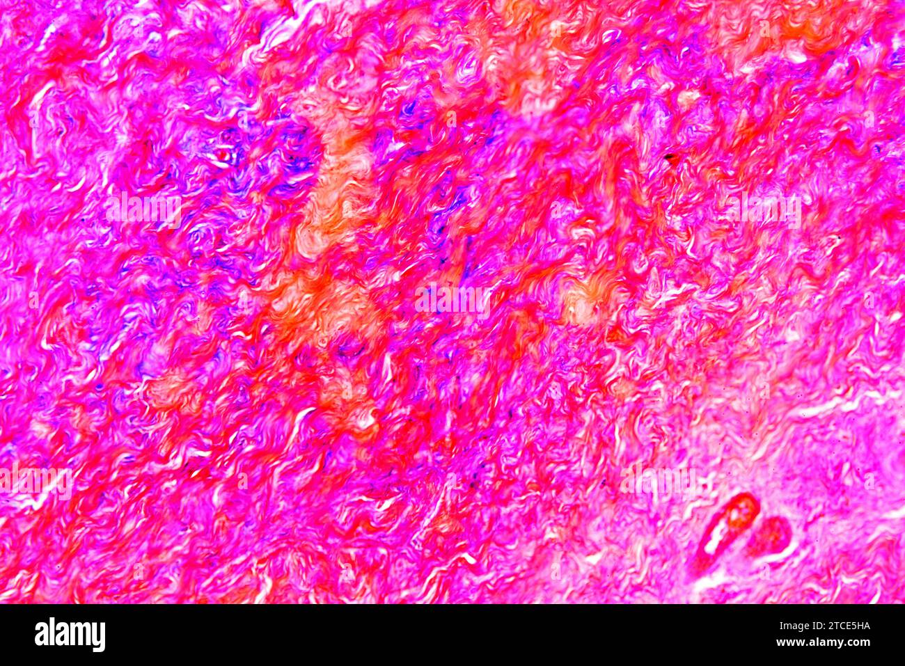 Tissu de fibrocartilage montrant des fibres de collagène. Microscope optique X100. Banque D'Images