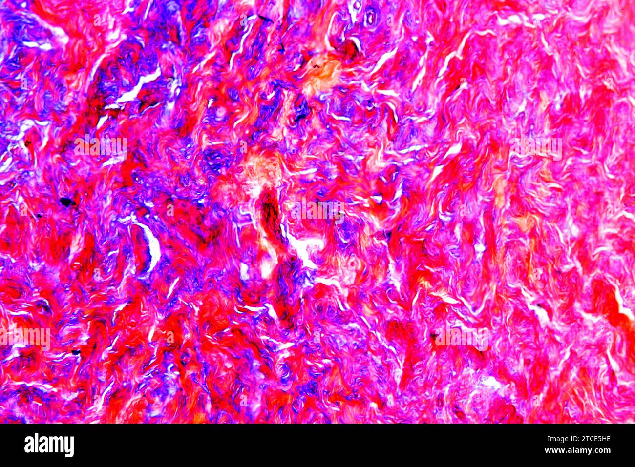 Tissu de fibrocartilage montrant des fibres de collagène. Microscope optique X100. Banque D'Images