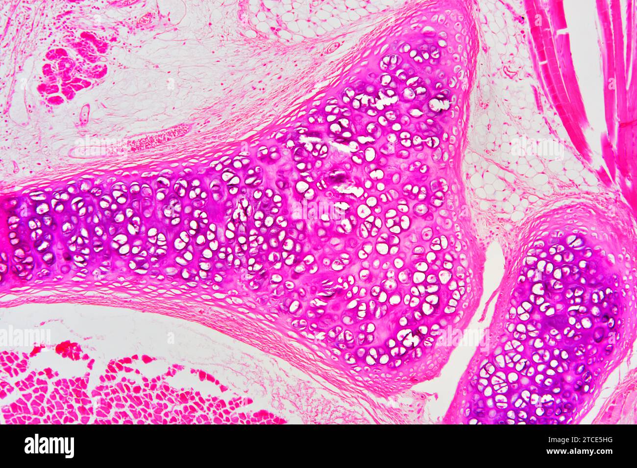Cartilage hyaliné de la trachée montrant des chondrocytes, des fibres de collagène et une matrice. Microscope optique X100. Banque D'Images