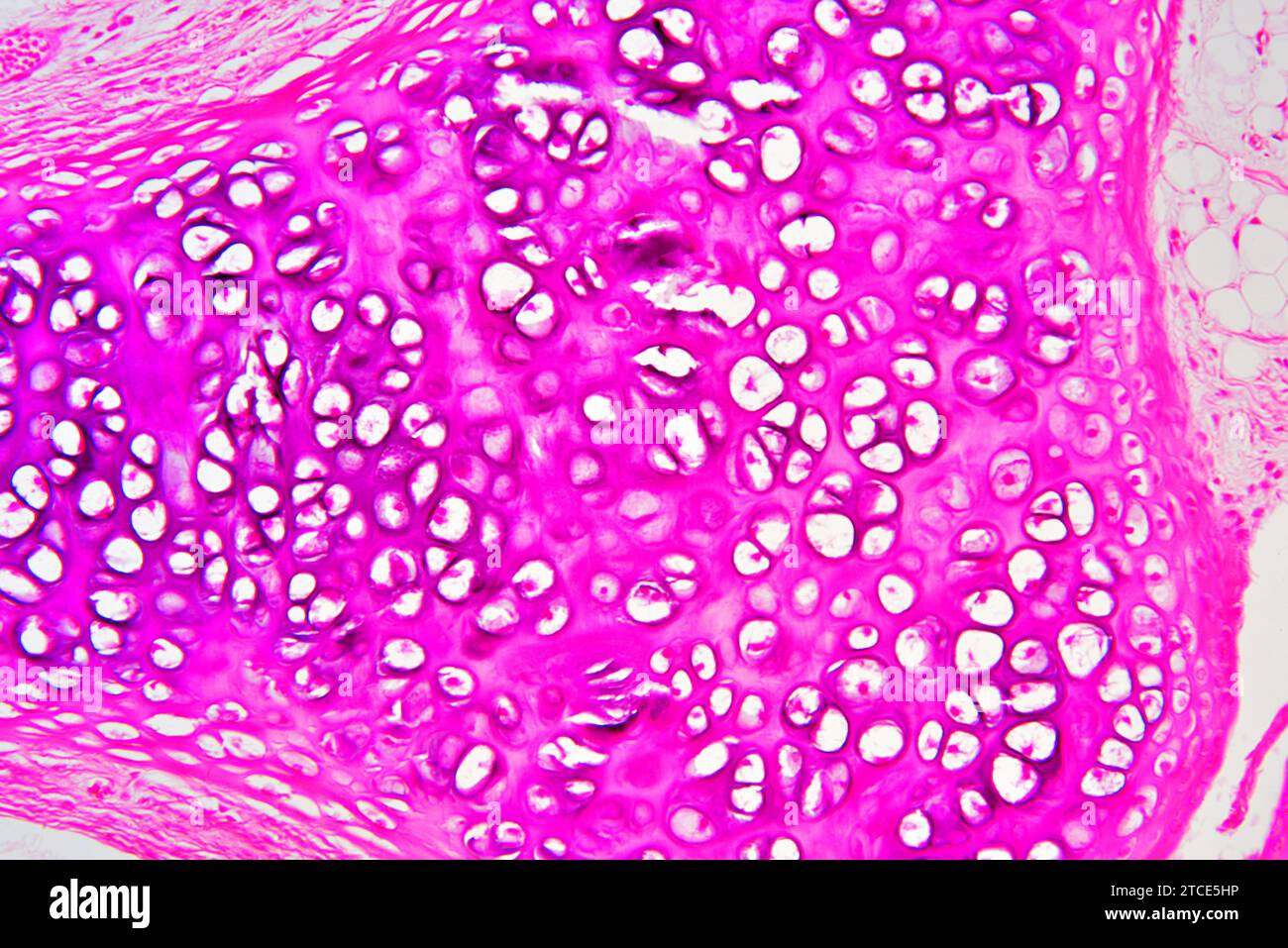 Cartilage hyaliné de la trachée montrant des chondrocytes, des fibres de collagène et une matrice. Microscope optique X200. Banque D'Images