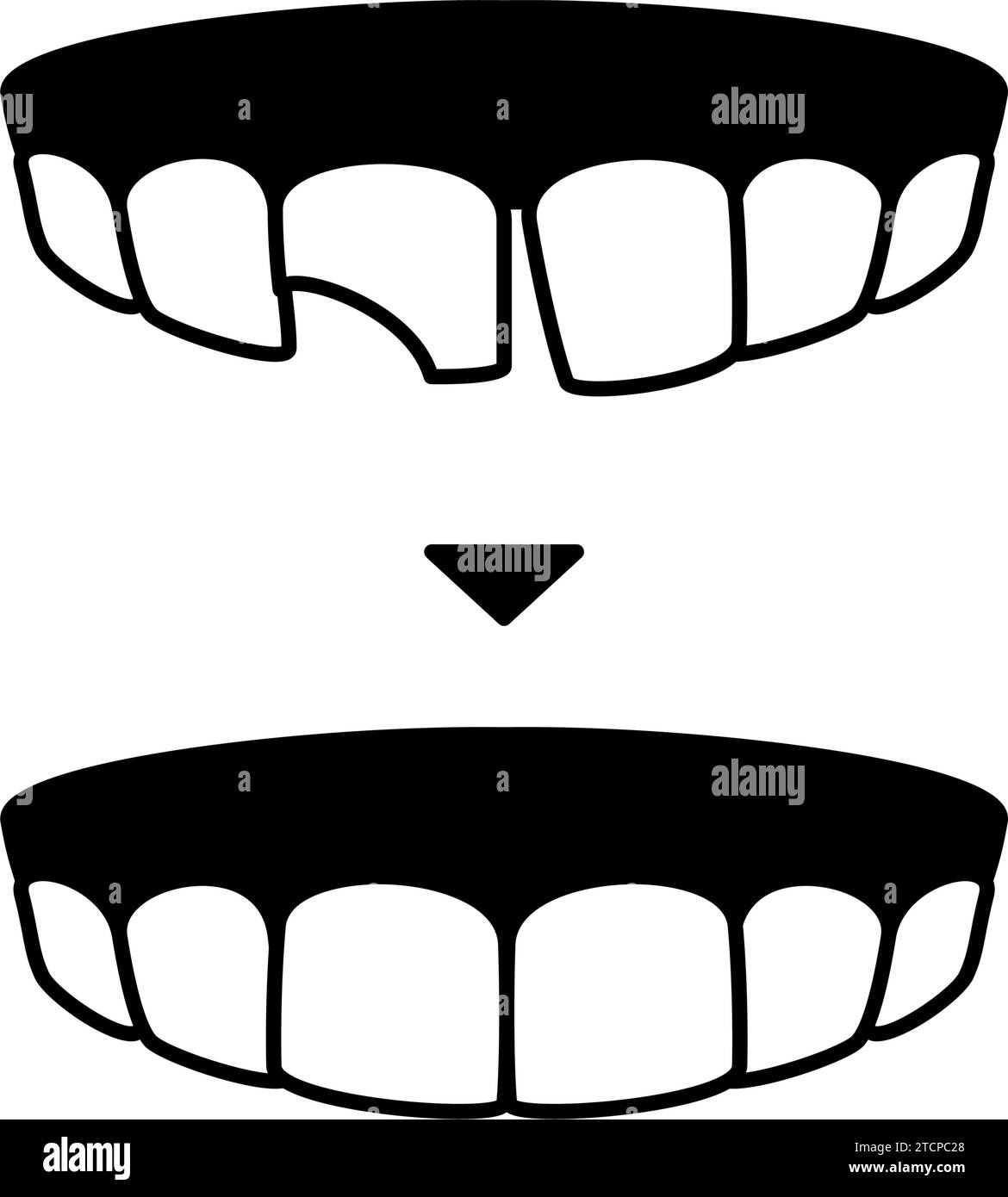 Dentisterie esthétique, collage direct avant et après, dessin au trait simple, illustration vectorielle Illustration de Vecteur