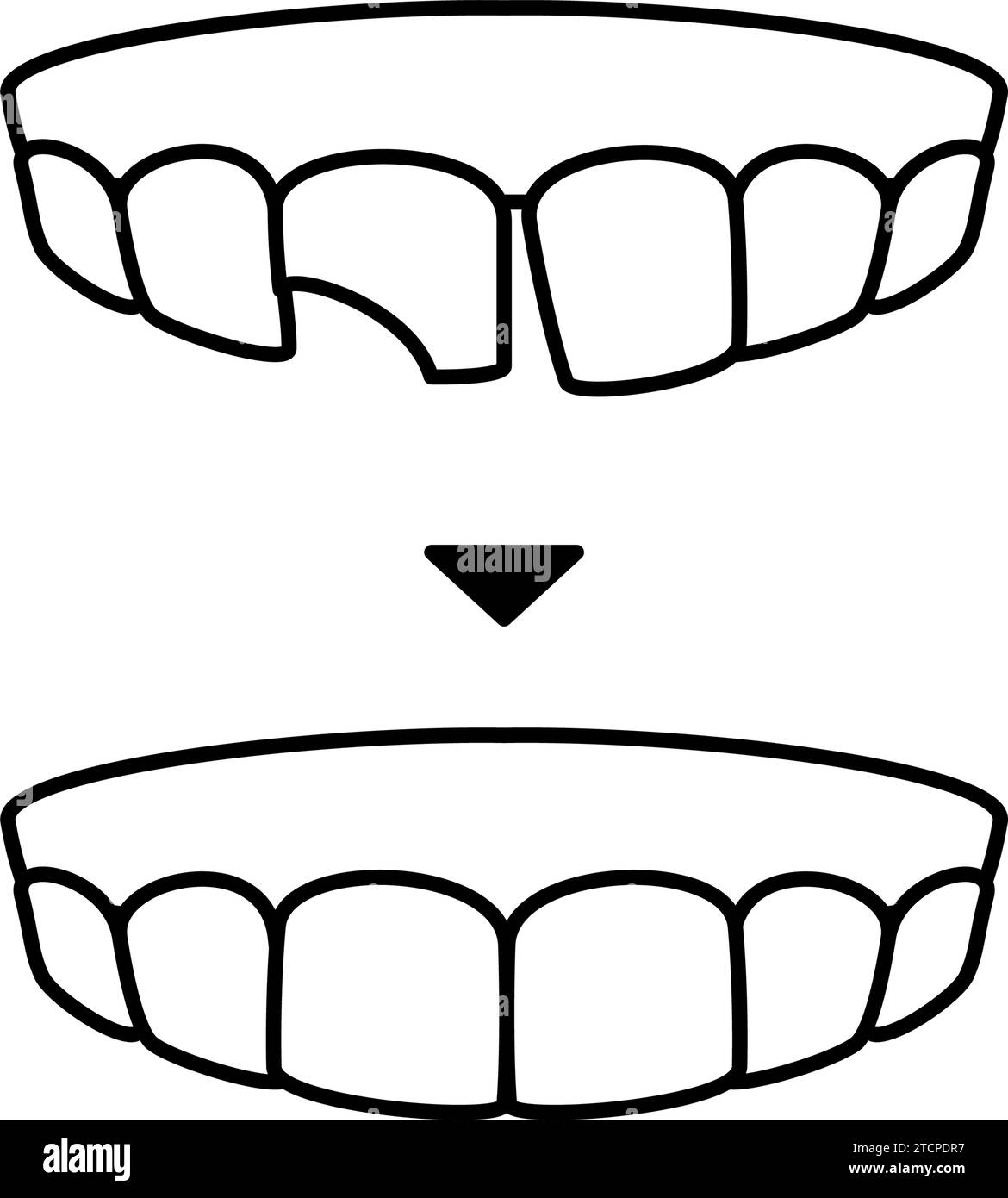 Dentisterie esthétique, collage direct avant et après, dessin au trait simple, illustration vectorielle Illustration de Vecteur