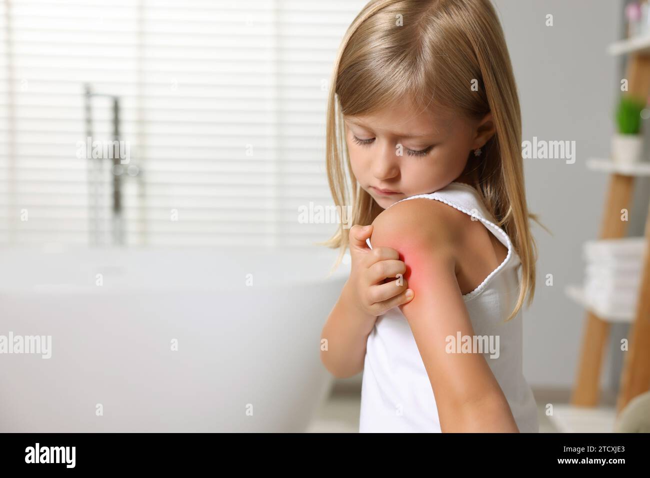 Souffrant d'allergie. Petite fille se grattant l'épaule dans la salle de bain, espace pour le texte Banque D'Images