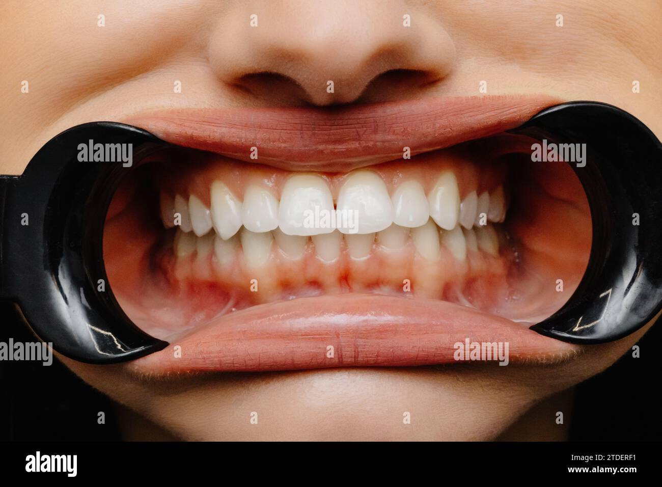 Gros plan de la cavité de la femme protégée par un enrouleur montrant des dents parfaites. Banque D'Images Gros plan de la cavité de la femme protégée par un enrouleur montrant des dents parfaites. Banque D'Images