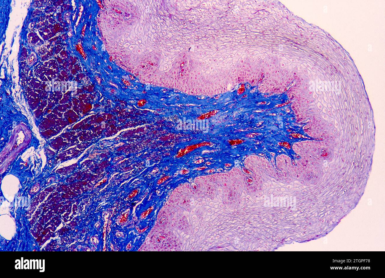 Épithélium squameux stratifié provenant de l'œsophage humain. Photomicrographe. Banque D'Images