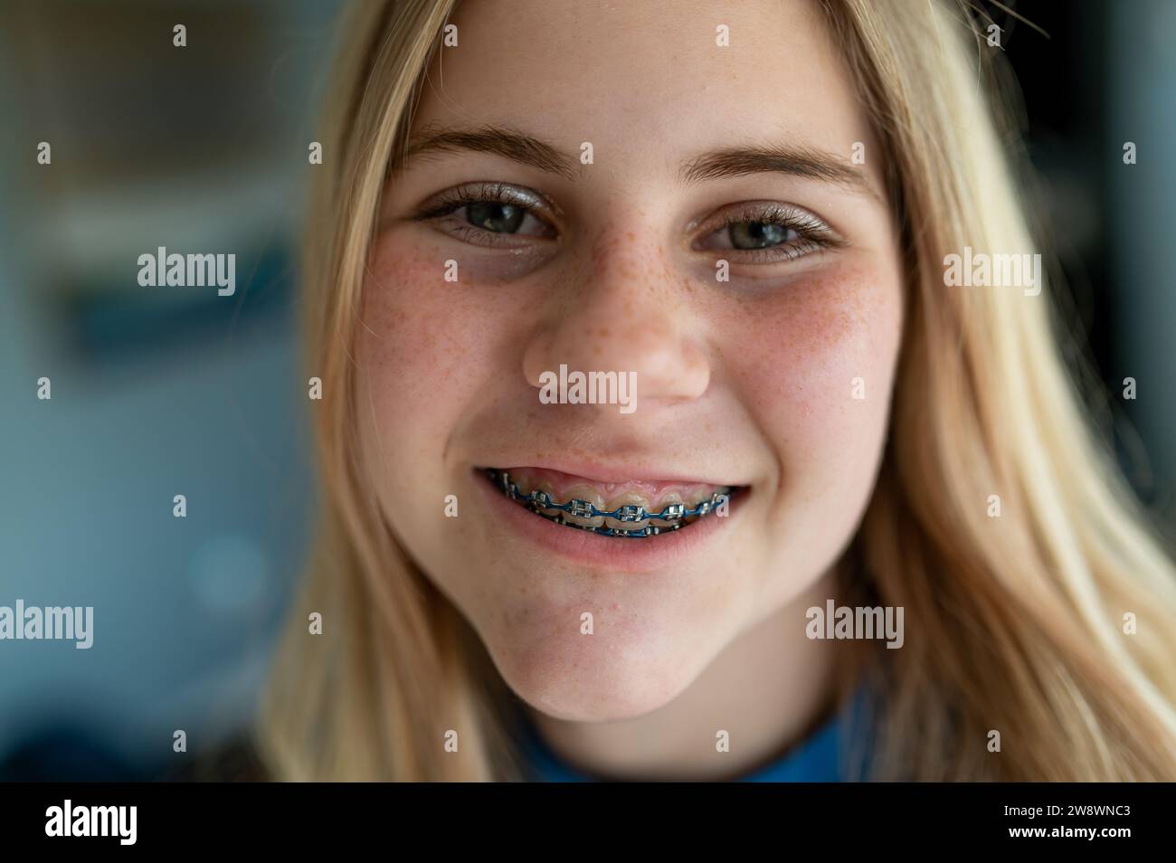 Tween fille avec des bretelles rapprochées souriant Banque D'Images