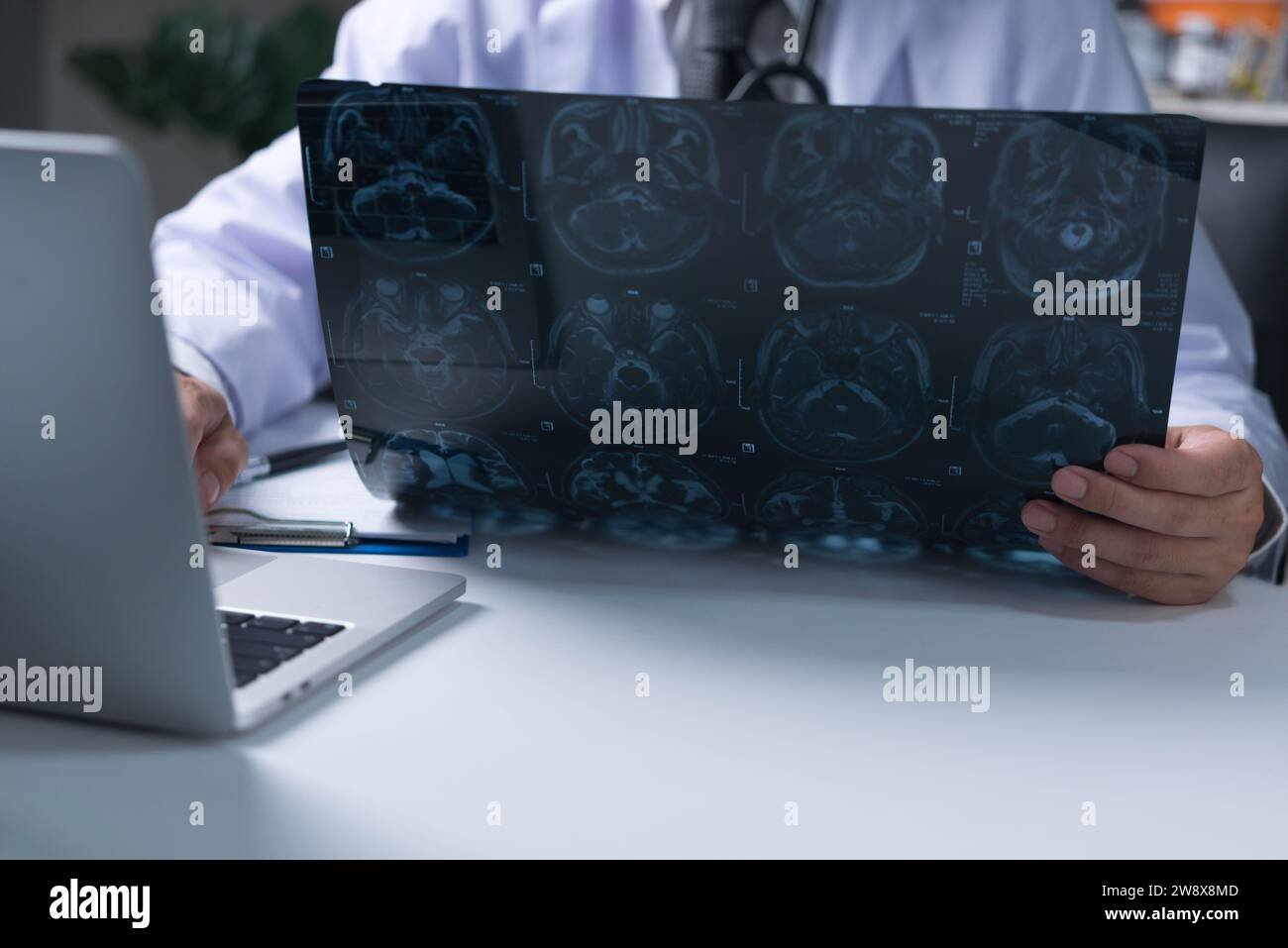 Les médecins utilisent des images diagnostiques de radiographie de film les aider à diagnostiquer les maladies du patient Banque D'Images