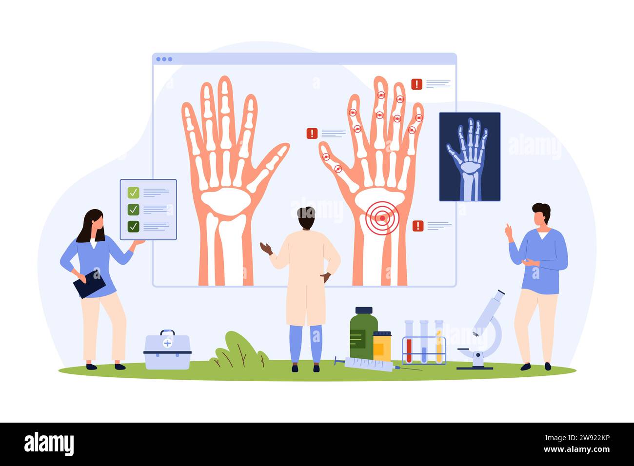 Polyarthrite rhumatoïde, arthrose, rhumatisme du poignet et des doigts illustration de vecteur de diagnostic. Cartoon Tiny People recherche la radiographie des mains des patients atteints de maladie auto-immune, inflammation articulaire Illustration de Vecteur