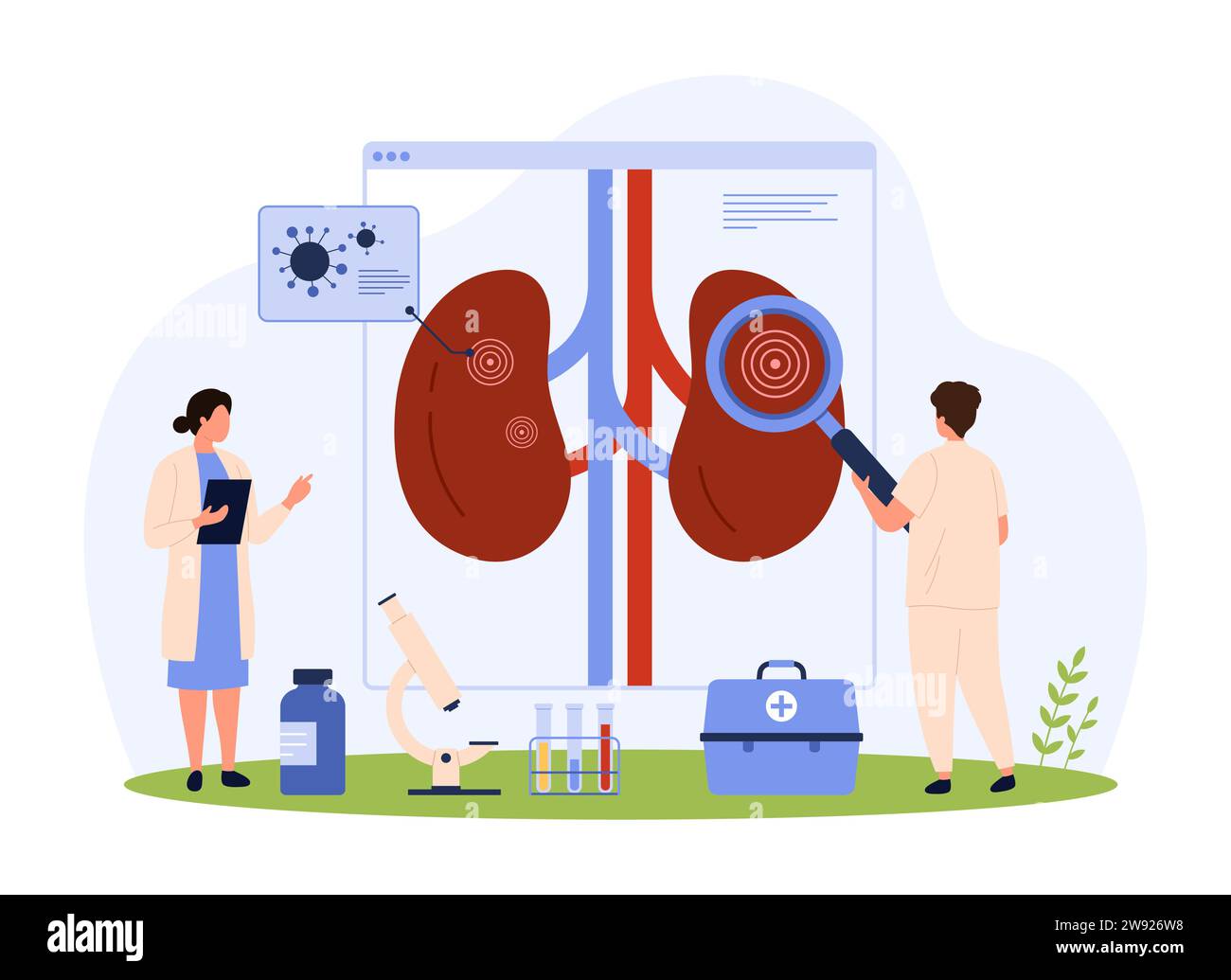 Pyélonéphrite, diagnostic et traitement de l'infection rénale, illustration vectorielle de néphrologie. Les minuscules gens de bande dessinée vérifient la santé du système urinaire avec la loupe, la recherche sur les maladies chroniques et les bactéries Illustration de Vecteur