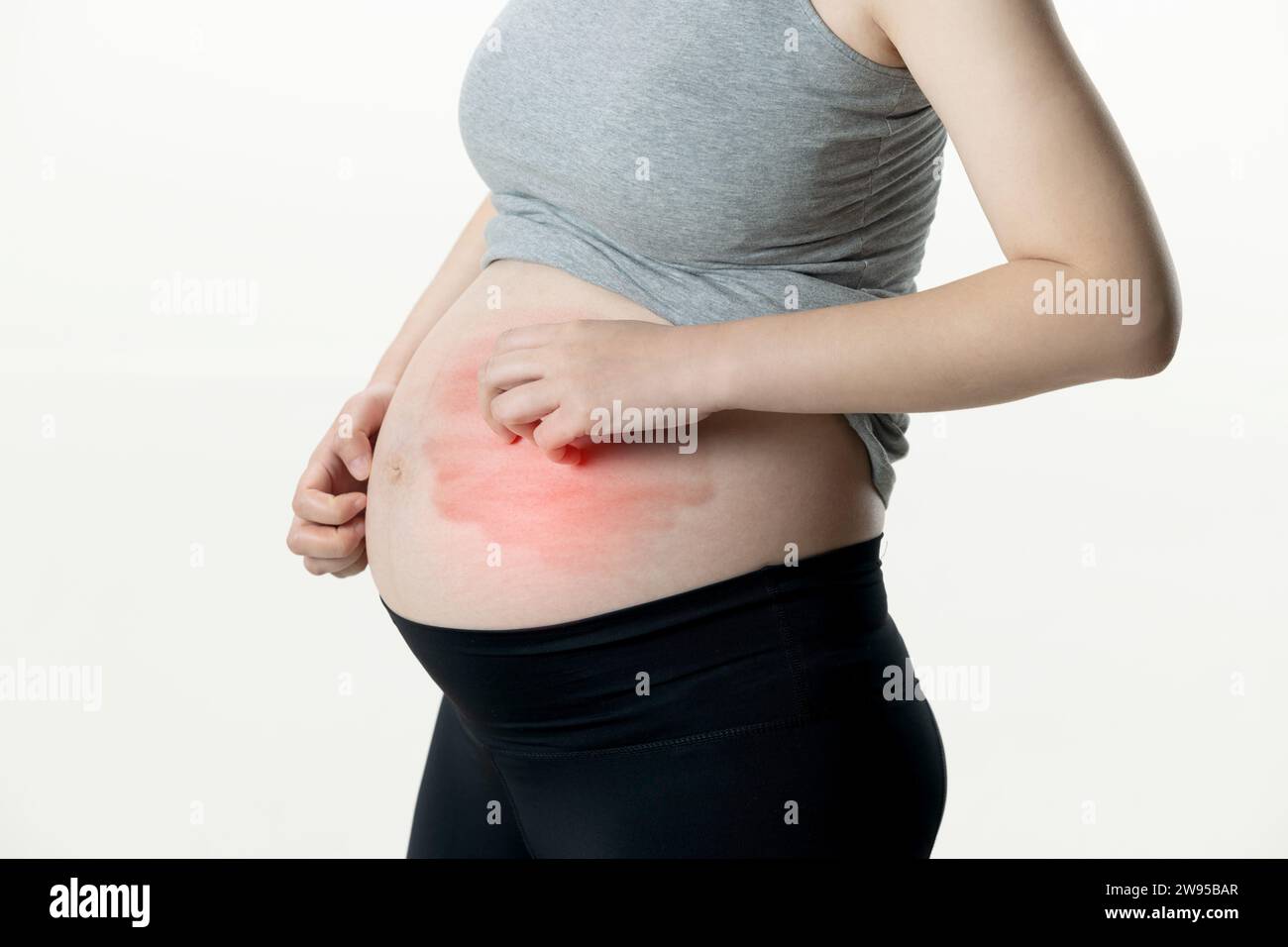 Femme enceinte souffrant de démangeaisons, surlignée en rouge Banque D'Images