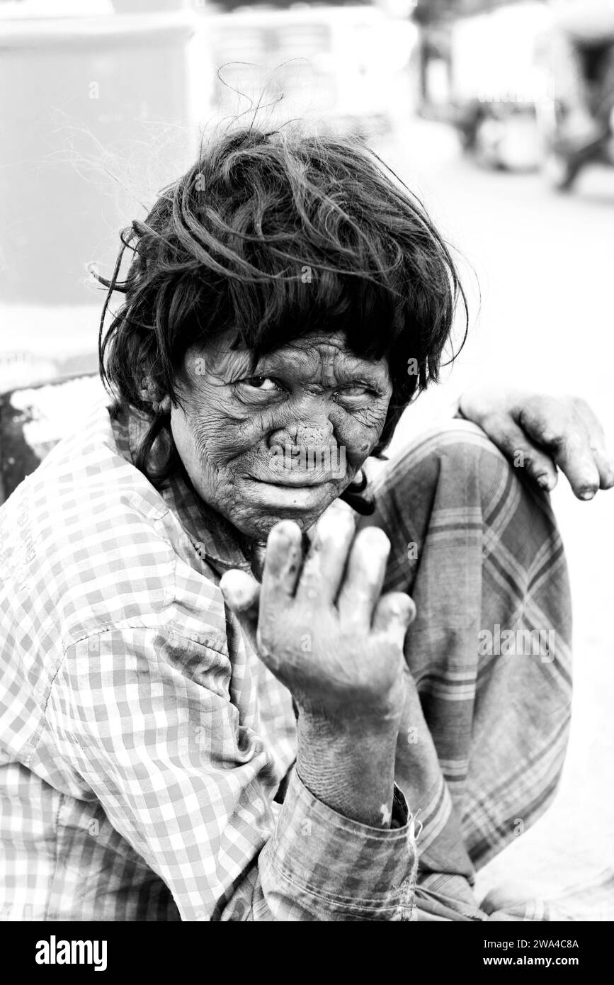 Portrait d'un lépreux pris à Hyderabad, en Inde. Banque D'Images