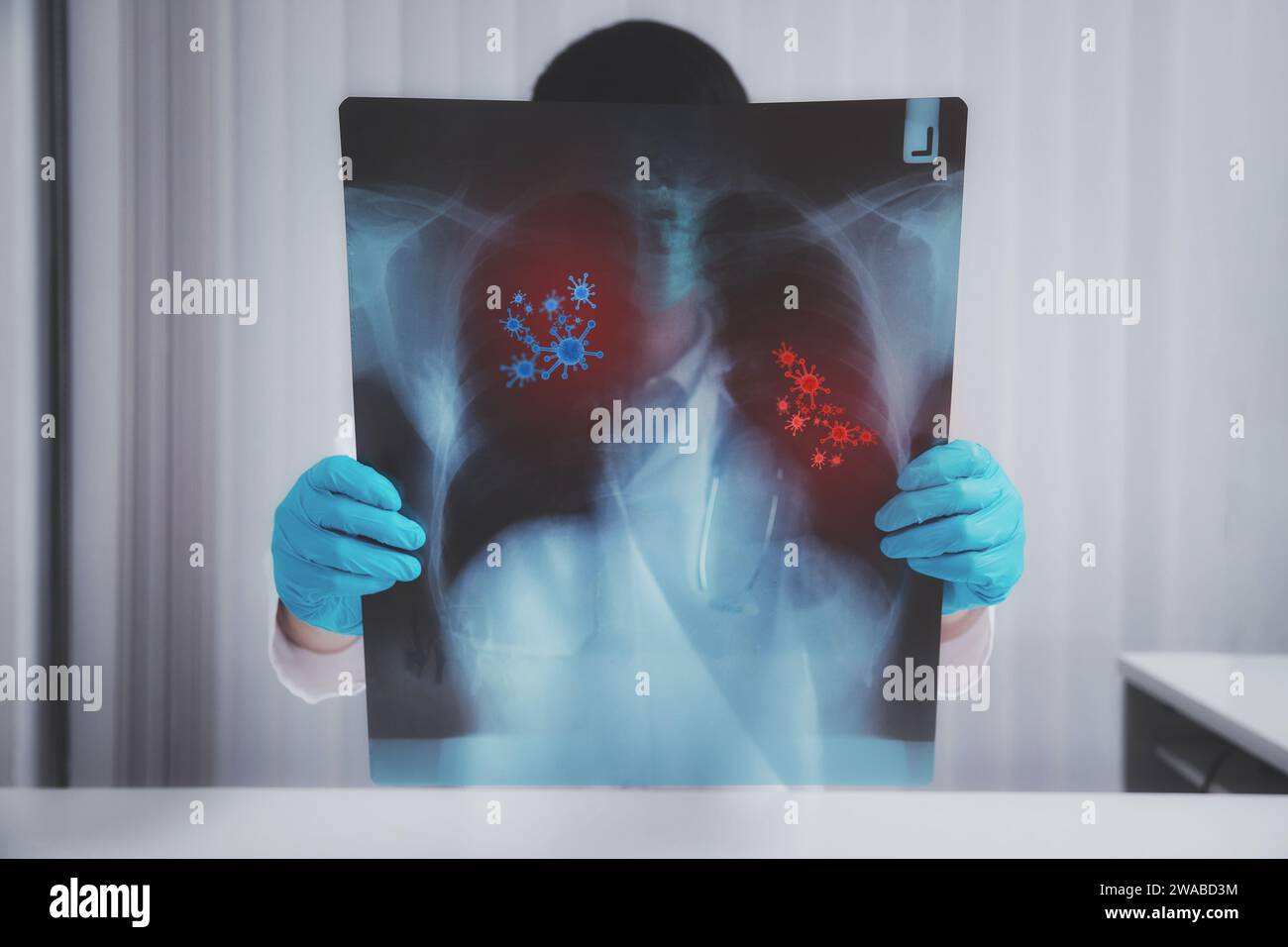 Un médecin diagnostique les résultats des rayons X pulmonaires des patients infectés par le coronavirus. Banque D'Images