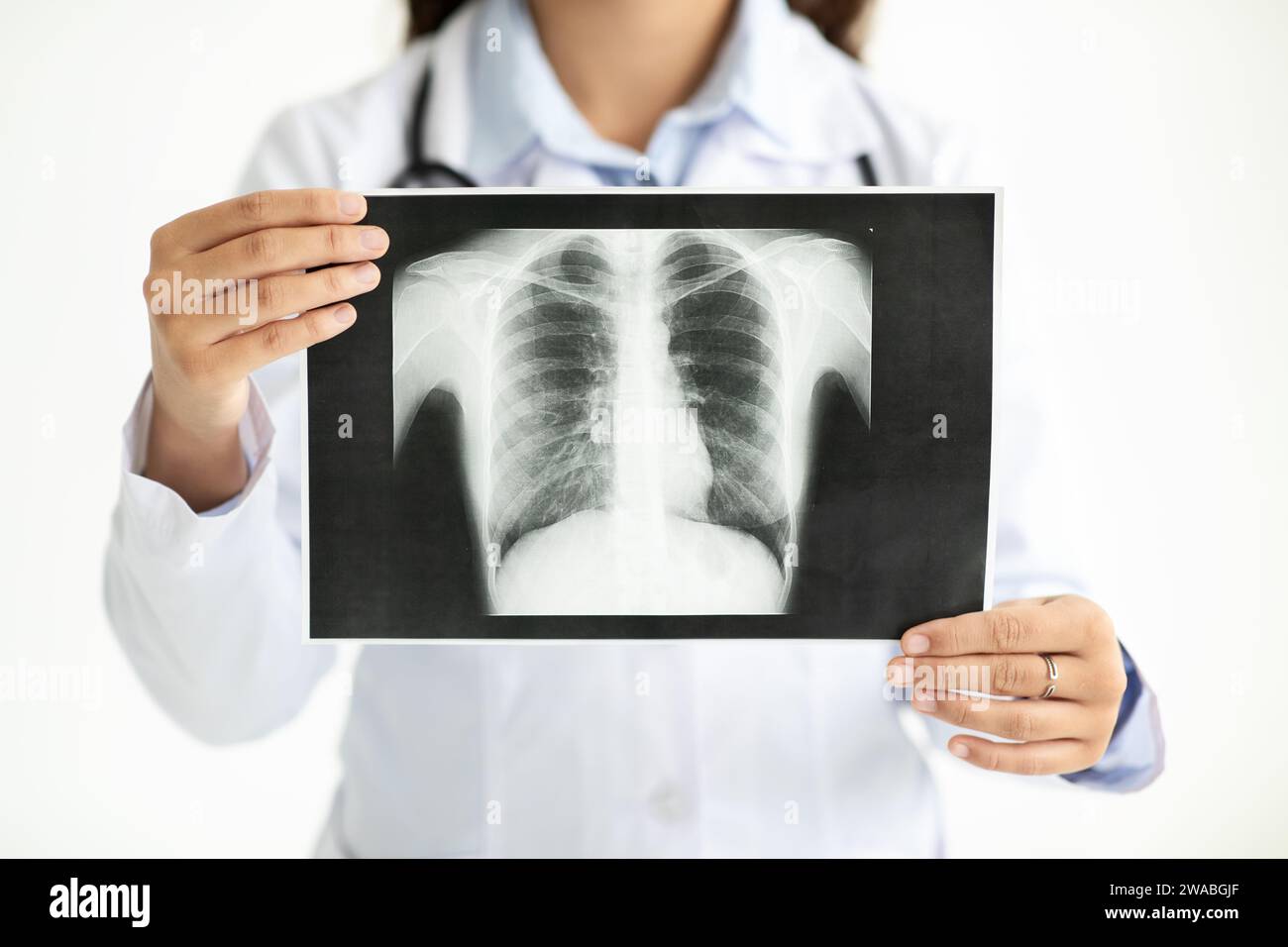 Femme médecin méconnaissable montrant le scanner du patient Banque D'Images