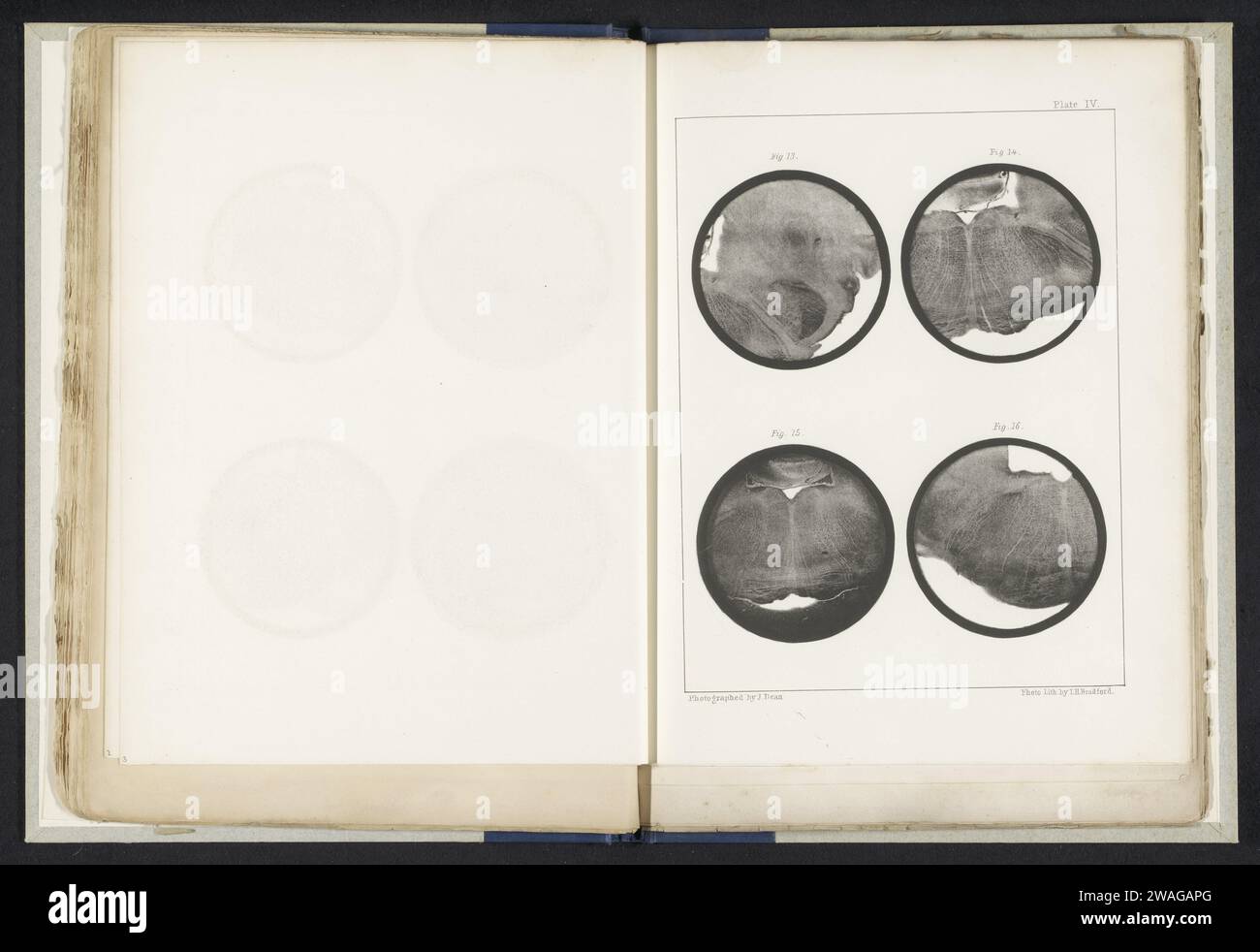 Quatre détails d'une medulla oblongata d'un mouton, John Dean, c. 1854 - dans ou avant 1864 impressions photomécanique papier cerveaux de photolithographie Banque D'Images