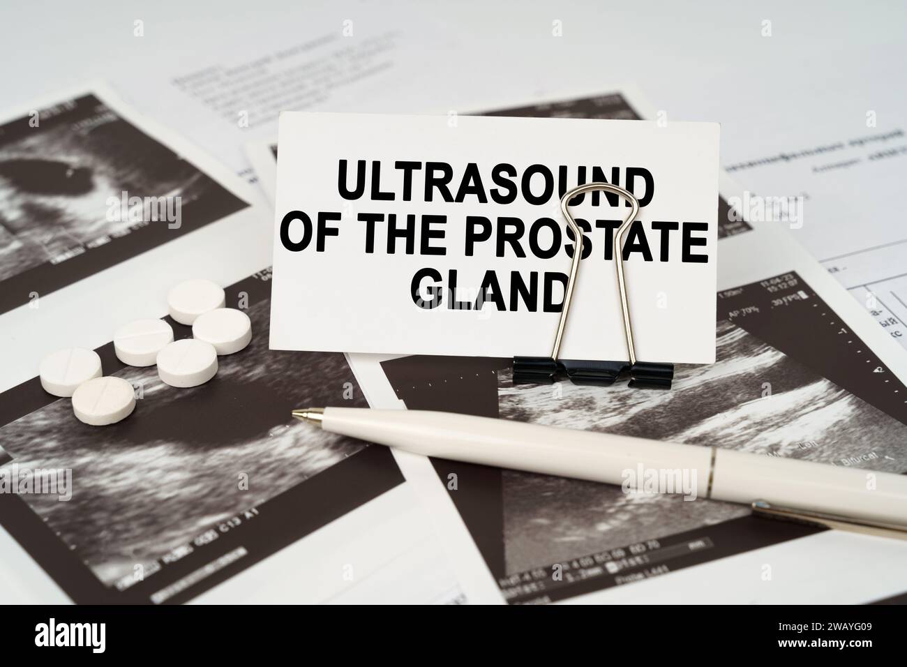 Prostate Echo Concept médical. Sur les images échographiques, il y a un stylo et une ...