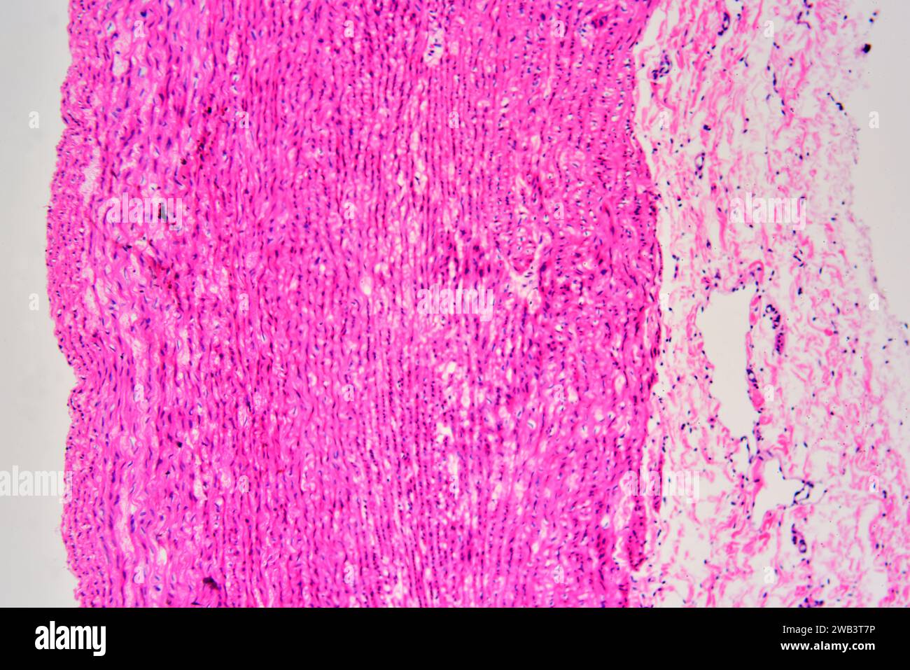 Section transversale de l'artère humaine montrant l'extéria de tunica, les milieux de tunica avec des fibres musculaires lisses et l'intima de tunica. X75 à 10 cm de large. Banque D'Images