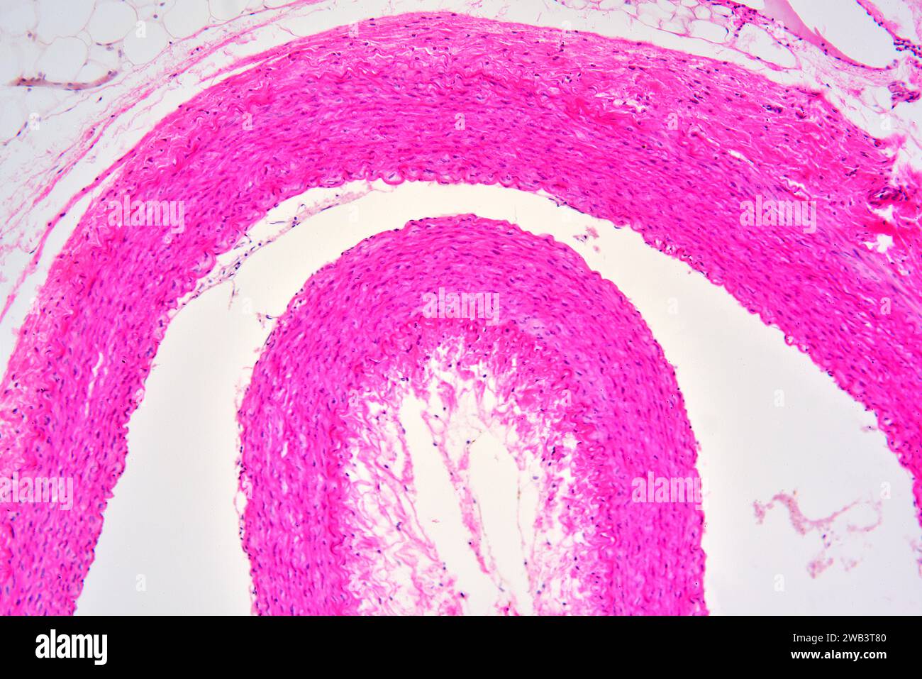 Section transversale de l'artère humaine montrant l'extéria de tunica, les milieux de tunica avec des fibres musculaires lisses et l'intima de tunica. X75 à 10 cm de large. Banque D'Images