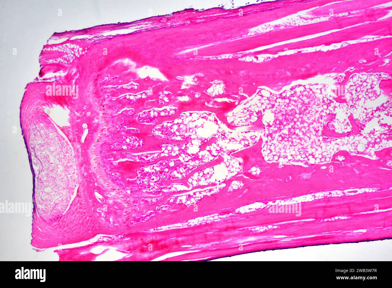Conection muscle-tendon dans un os long. X25 à 10 cm de large. Banque D'Images Conection muscle-tendon dans un os long. X25 à 10 cm de large. Banque D'Images
