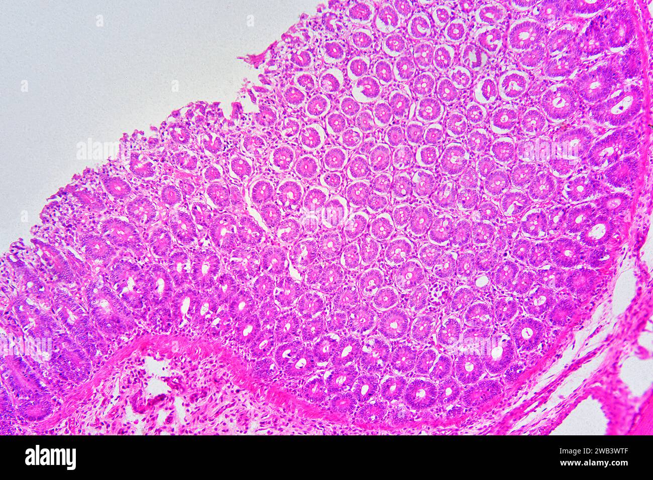 Rectum humain montrant de haut en bas : muqueuse avec glandes intestinales, lamina propria et sous-muqueuse. X75 à 10 cm de large. Banque D'Images