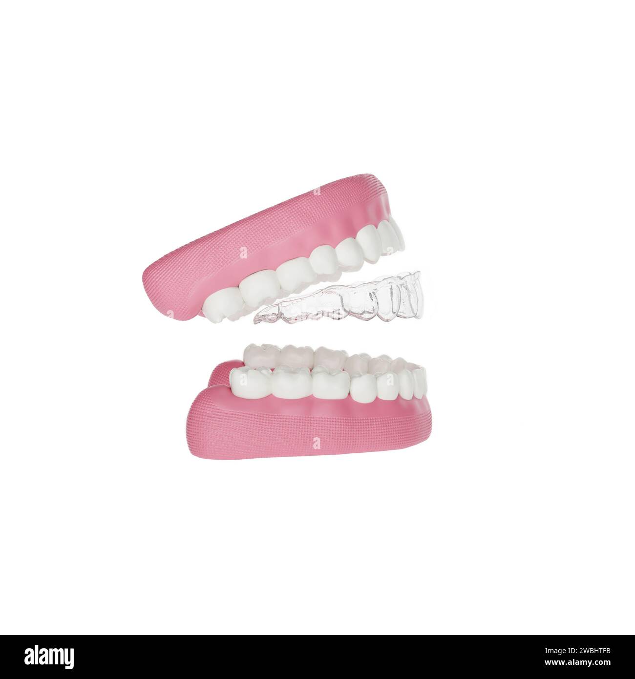 Image de haute qualité d'un aligneur en plastique transparent invisible pour les dents supérieures, avec modèle de mâchoire 3D. Banque D'Images